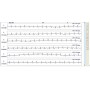 48h Langzeit-EKG mit Rekorder und Software