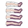 Medyczna terapia uciskowa atediMedical 1.0 do użytku profesjonalnego i domowego z 2 legginsami