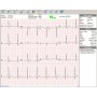Euro ECG BT12 Trådlös PC-EKG Elektrokardiograf