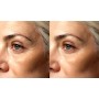 Ultrasuoni per la bellezza UltraSonicWaves Beauty dotazione VISO e DECOLLETE