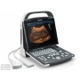 Nuovo ecografo mindray dp-20
